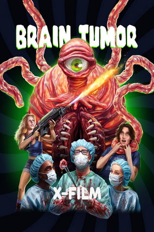 смотреть Опухоль мозга (2024)